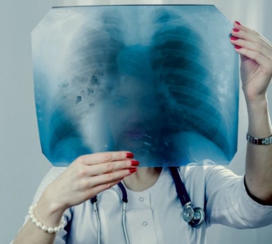 Pasaules tuberkulozes dienā aicina pievērst uzmanību veselībai