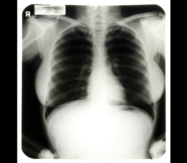 1954. gadā tapušais Merilinas Monro plaušu rentgena uzņēmums ir ticis pārdotas par 45 000 dolāru.